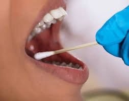 DNA testing collection