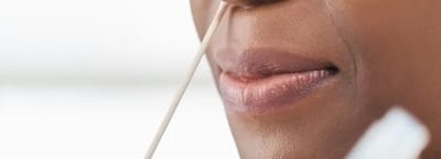CLIA-waived rapid testing